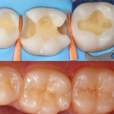 Slider image (3) THE DENTAL PORT